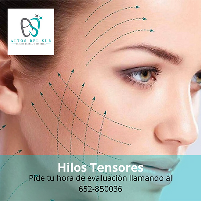 Hilos Tensores